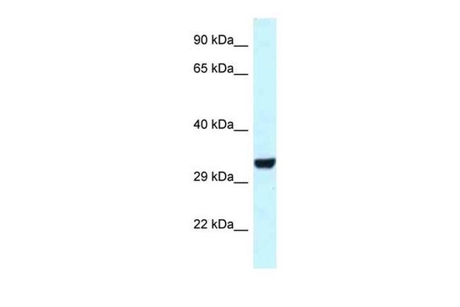 HEY1 Antibody in Western Blot (WB)