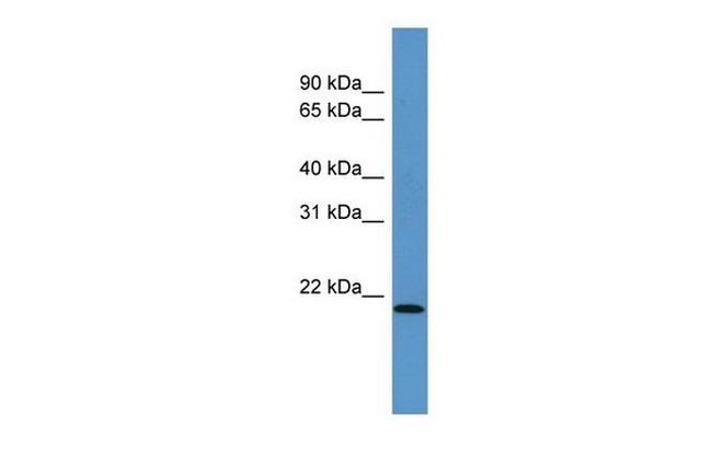 ARPC4 Antibody in Western Blot (WB)