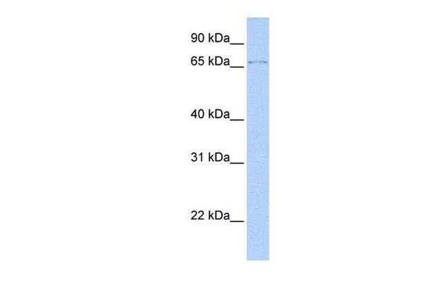 ZFP64 Antibody in Western Blot (WB)