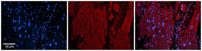 ZFP36L1 Antibody in Immunohistochemistry (Paraffin) (IHC (P))