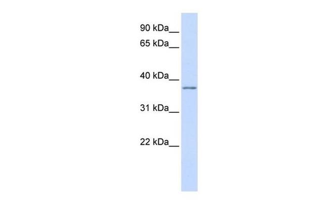 KVbeta2 (KCNAB2) Antibody in Western Blot (WB)