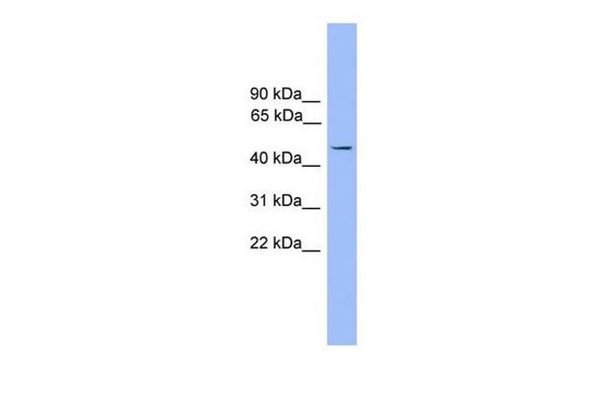 FOXJ1 Antibody in Western Blot (WB)