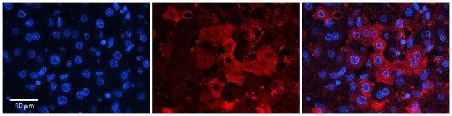 ZNF142 Antibody in Immunohistochemistry (Paraffin) (IHC (P))