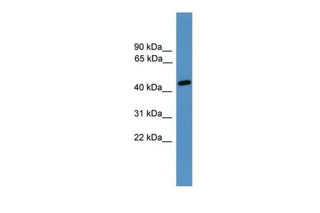 ELK3 Antibody in Western Blot (WB)