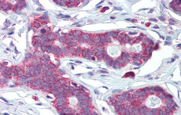 HOXA5 Antibody in Immunohistochemistry (Paraffin) (IHC (P))