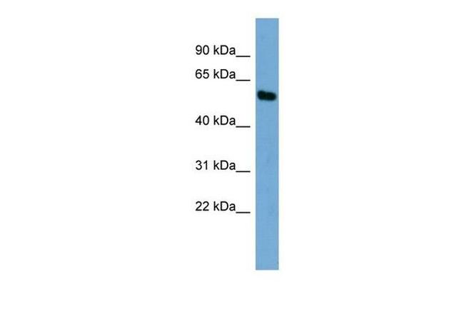 ZNF96 Antibody in Western Blot (WB)