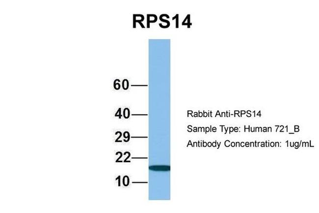 RPS14 Antibody in Western Blot (WB)