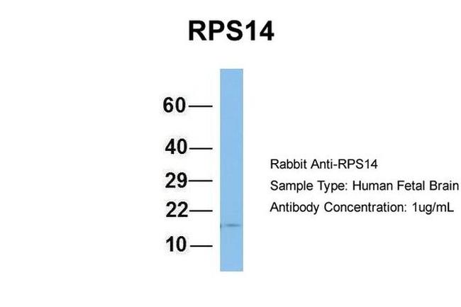 RPS14 Antibody in Western Blot (WB)