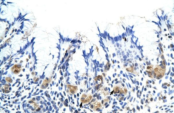 CSH1 Antibody in Immunohistochemistry (Paraffin) (IHC (P))