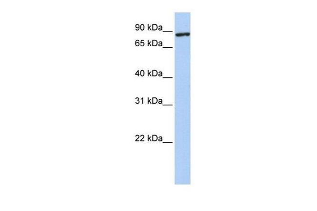 TMEM63A Antibody in Western Blot (WB)