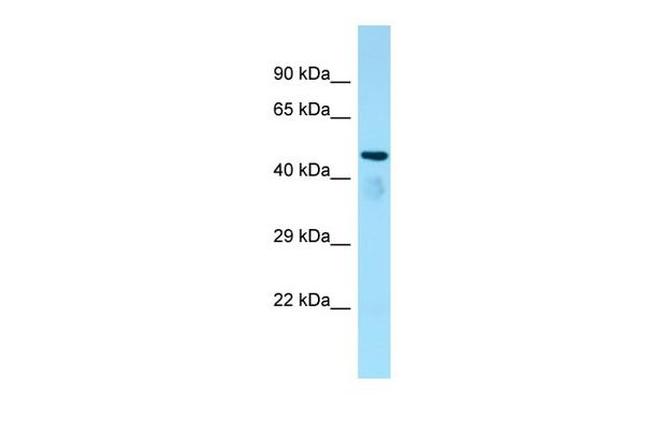 ATAT1 Antibody in Western Blot (WB)