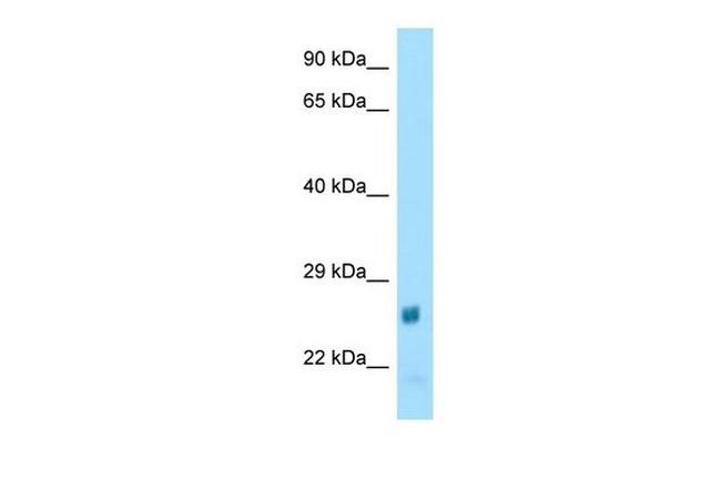 NAT15 Antibody in Western Blot (WB)