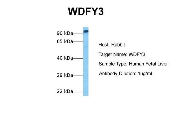 WDFY3 Antibody in Western Blot (WB)