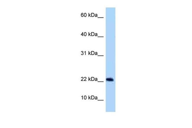 SPACA9 Antibody in Western Blot (WB)