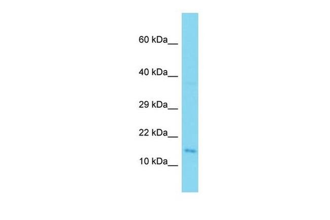 SPACA9 Antibody in Western Blot (WB)