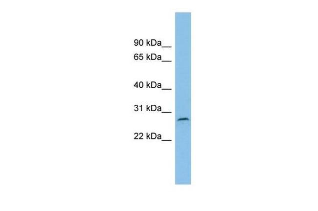 C1orf104 Antibody in Western Blot (WB)