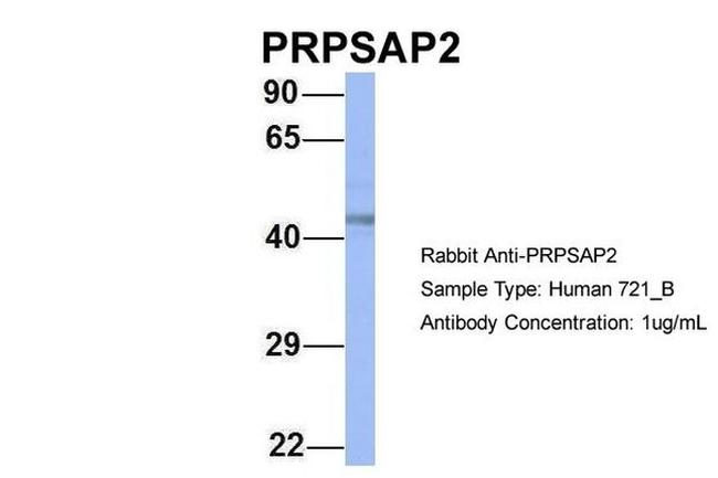 PRPSAP2 Antibody in Western Blot (WB)