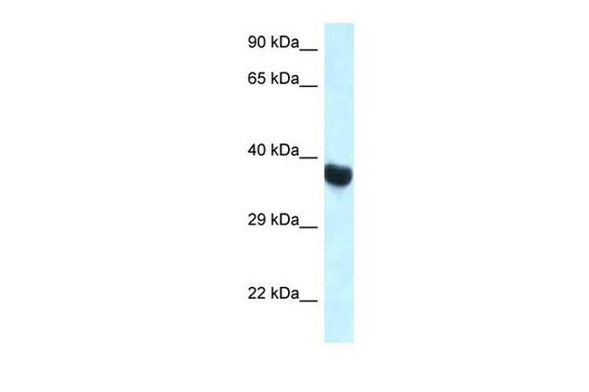 HOXA11 Antibody in Western Blot (WB)