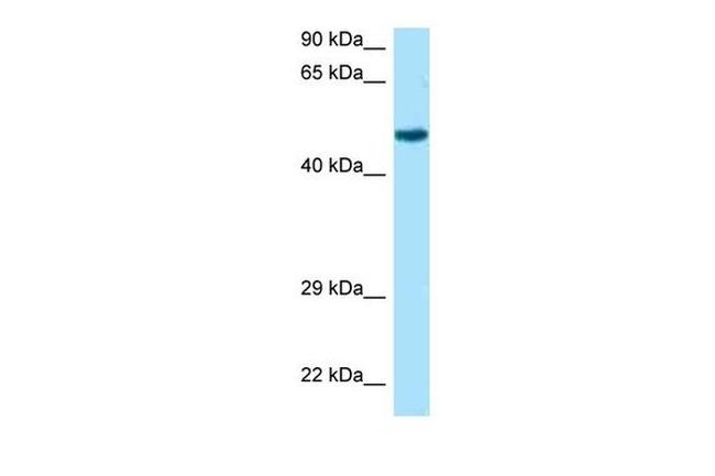 RCC1 Antibody in Western Blot (WB)