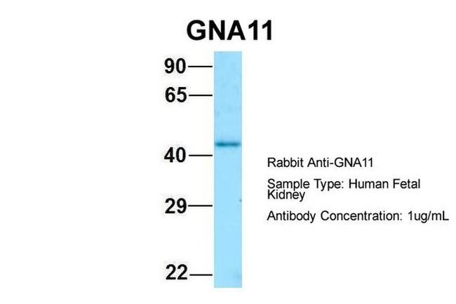 GNA11 Antibody in Western Blot (WB)