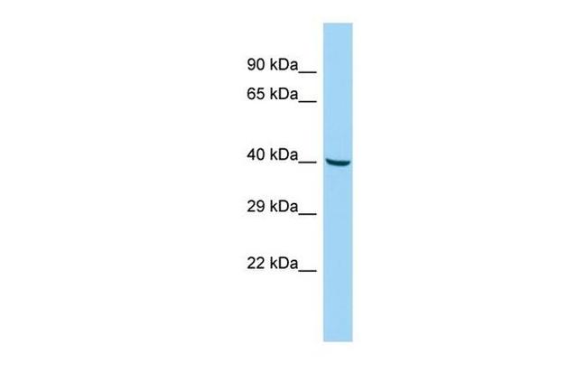 SLC35G3 Antibody in Western Blot (WB)