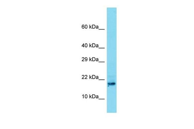 TDRP Antibody in Western Blot (WB)