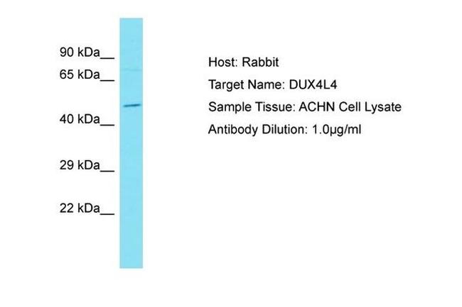 DUX1 Antibody in Western Blot (WB)