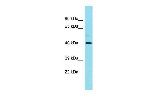 FAM181B Antibody in Western Blot (WB)