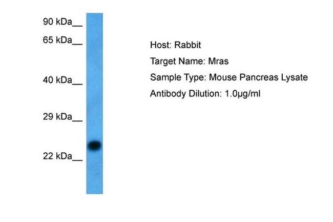 MRAS Antibody in Western Blot (WB)