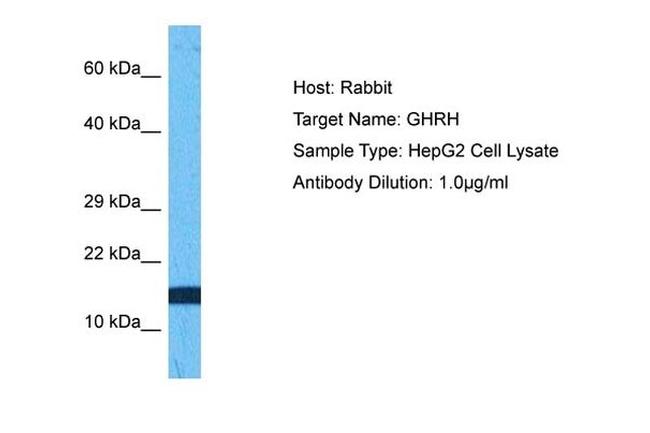 GHRH Antibody in Western Blot (WB)