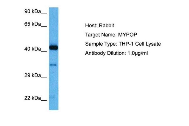 MYPOP Antibody in Western Blot (WB)