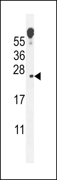 Vopp1 Antibody in Western Blot (WB)