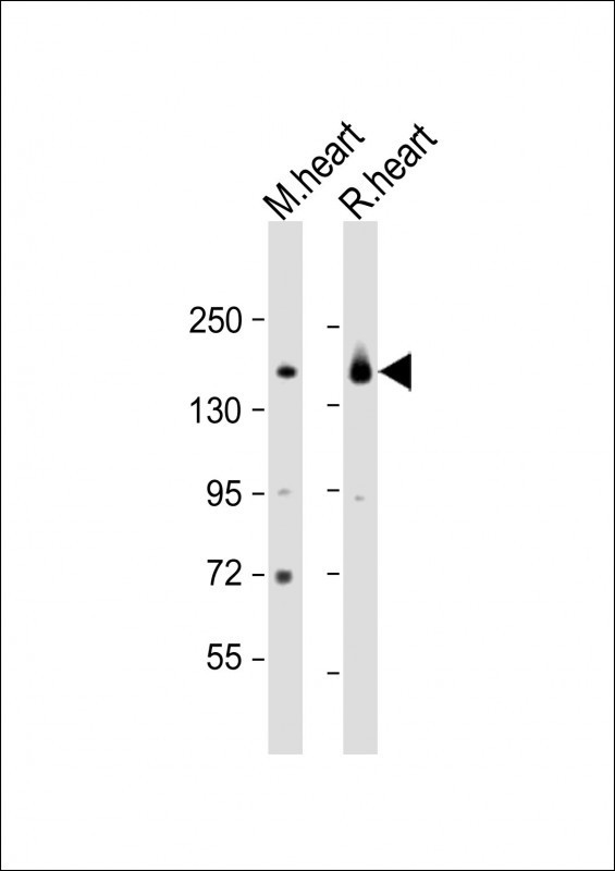 MYBPC3 Antibody in Western Blot (WB)