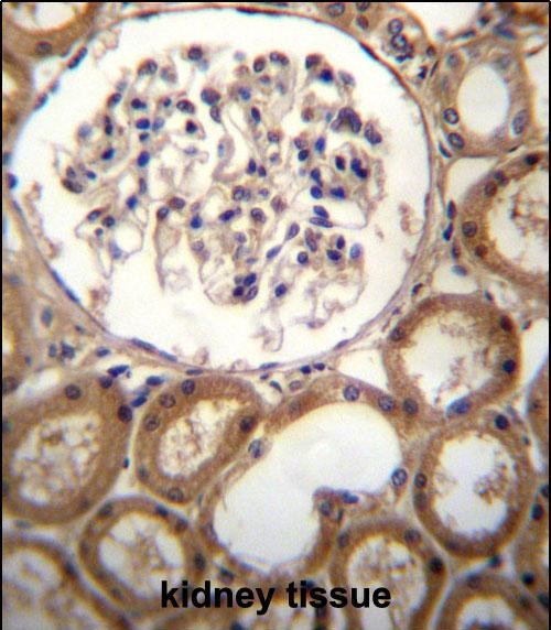 CLEC18A Antibody in Immunohistochemistry (Paraffin) (IHC (P))