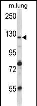 VPS54 Antibody in Western Blot (WB)