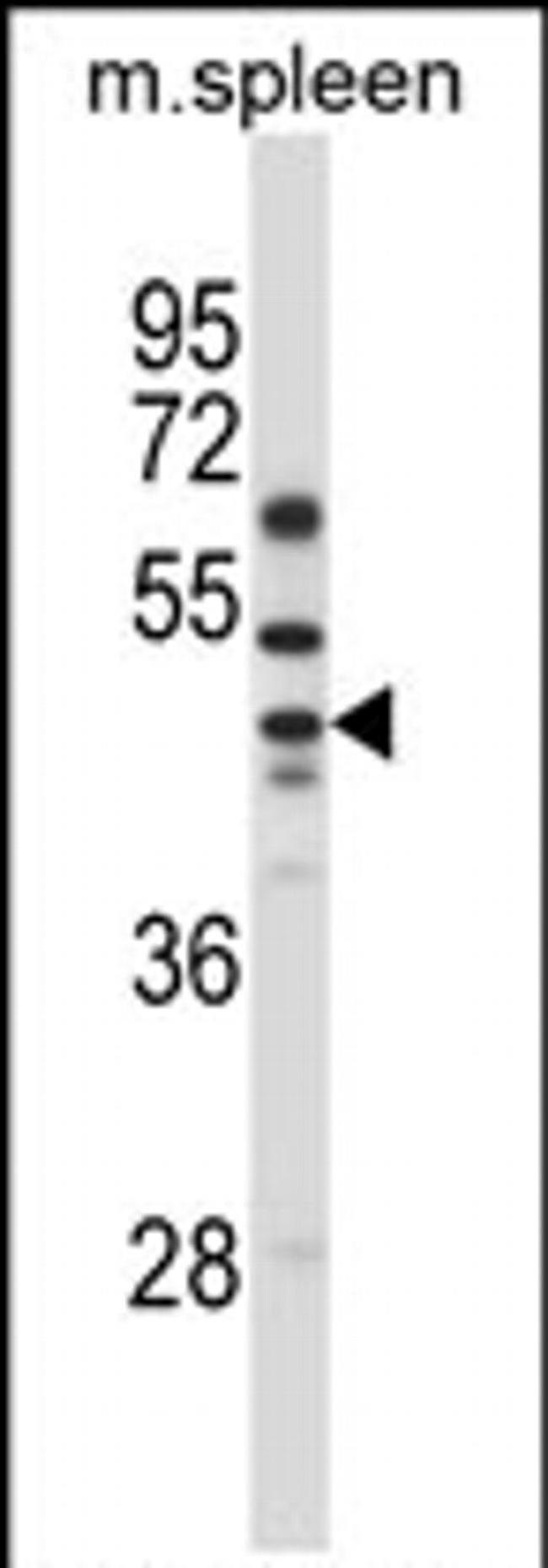 SLC30A6 Antibody in Western Blot (WB)