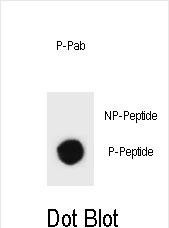 Phospho-TSC1 (Ser312) Antibody in Dot Blot (DB)