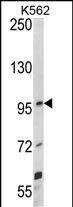 UNC5C Antibody in Western Blot (WB)