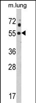 Kir2.1 (KCNJ2) Antibody in Western Blot (WB)