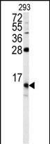 FKBP1B Antibody in Western Blot (WB)