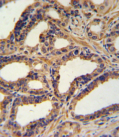 ANP Antibody in Immunohistochemistry (Paraffin) (IHC (P))