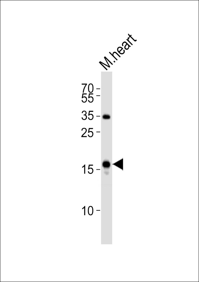 ANP Antibody in Western Blot (WB)