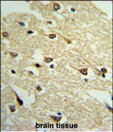 Adenylate Cyclase 8 Antibody in Immunohistochemistry (Paraffin) (IHC (P))