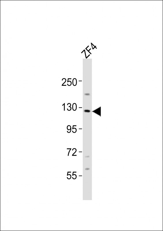 LOK Antibody in Western Blot (WB)