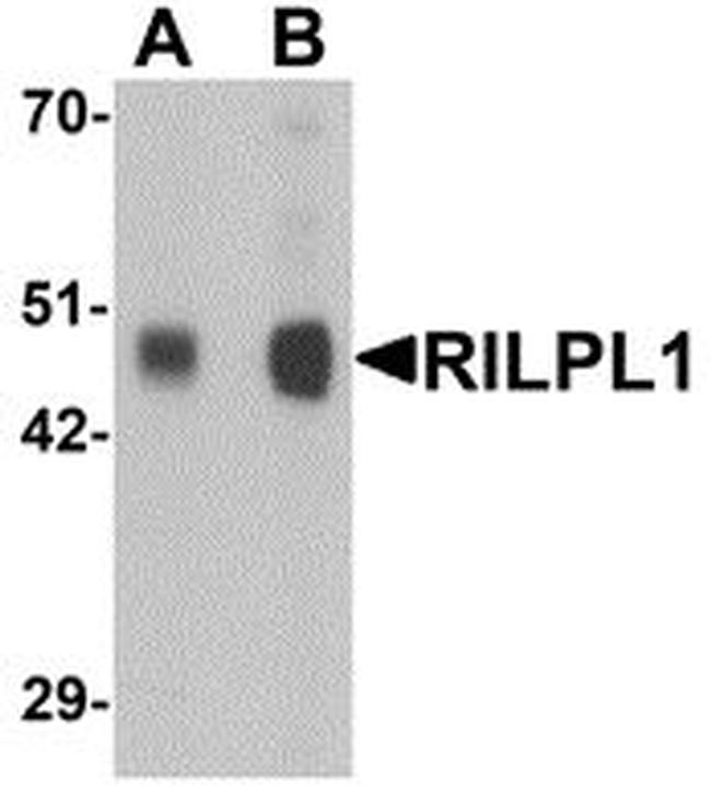 RILPL1 Antibody in Western Blot (WB)