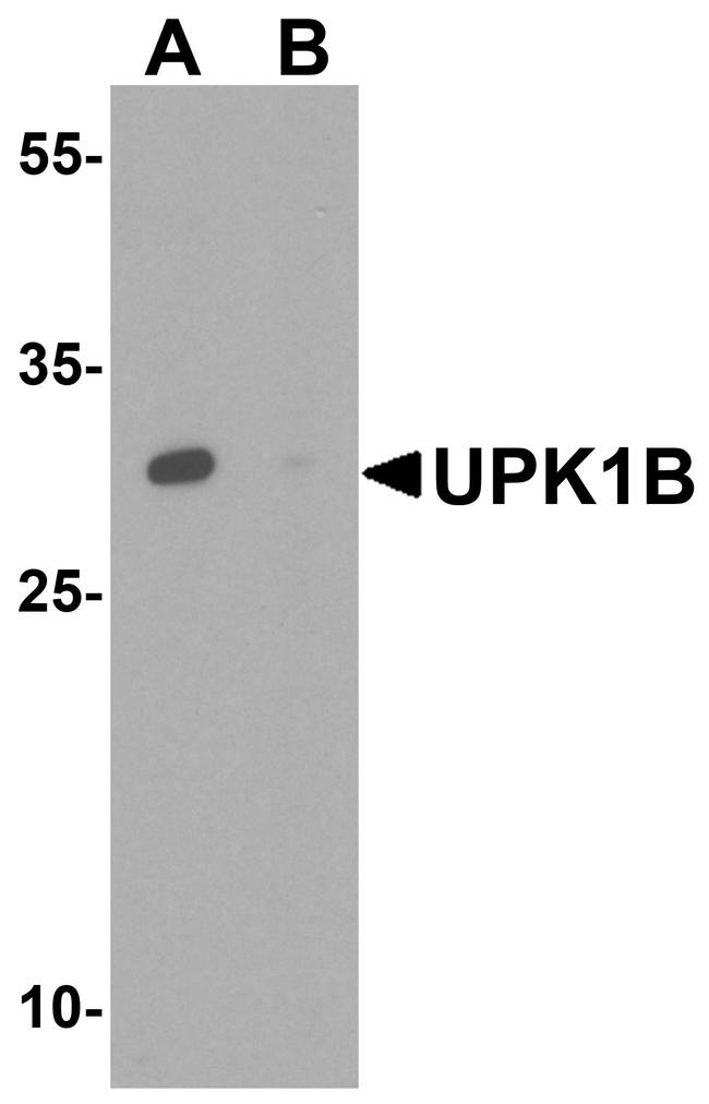 UPK1B Antibody in Western Blot (WB)