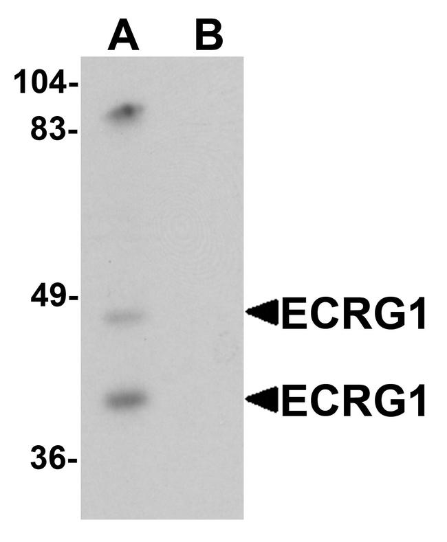 TMPRSS11A Antibody in Western Blot (WB)