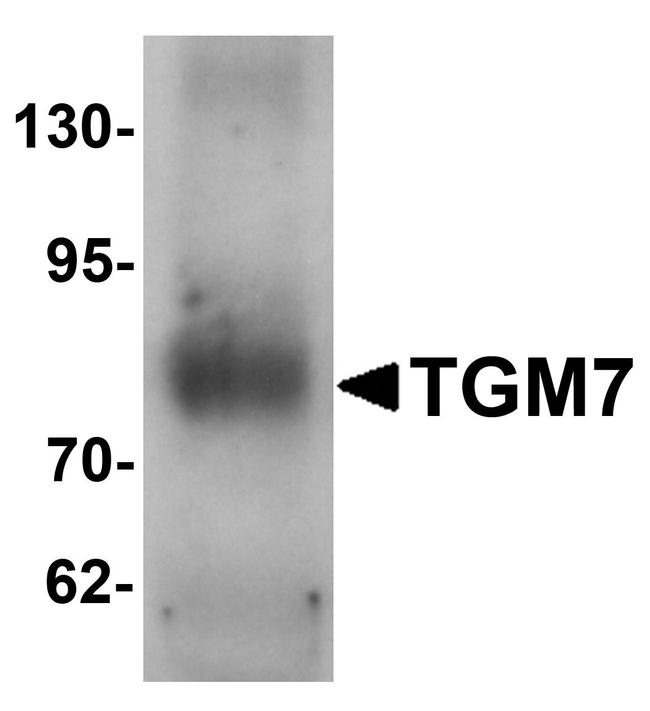 TGM7 Antibody in Western Blot (WB)