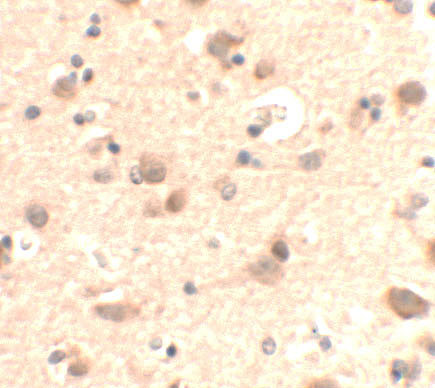 RUSC2 Antibody in Immunohistochemistry (Paraffin) (IHC (P))