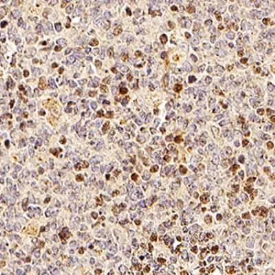 TRIP Antibody in Immunohistochemistry (Paraffin) (IHC (P))